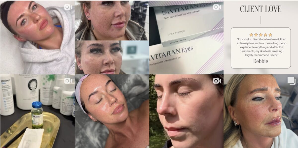 Instagram feed — treatments, results and skin tips from The Face Lab by Becci